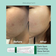 AXIS-Y DARKSPOT CORRECTING GLOW SERUM