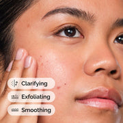 ORDINARY SALICYLIC ACID